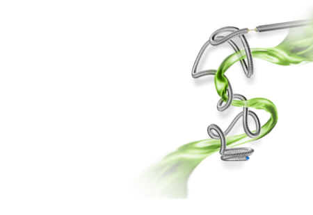 Intracranial aneurysm Large 1