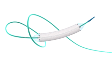 Intracranial aneurysm Willis 3