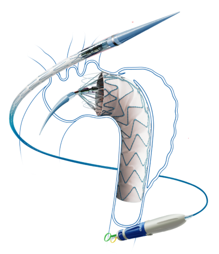 Thoracic Aortic Diseases Hercules Thoracic Stent Graft System 2