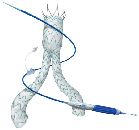 Abdominal Aortic Disease Minos Abdominal Aortic Stent Graft and Delivery System 1