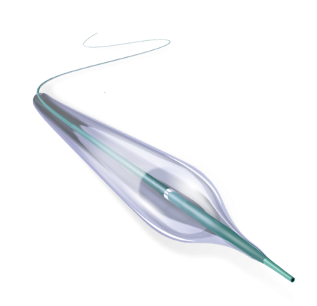 Peripheral Vascular Diseases Reewarm PTA Balloon Dilatation Catheter 2