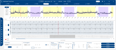 myPatch®sl 72h Eva in Synescope cloud mixed ECG 3