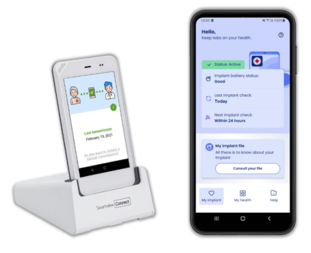 SmartView Connect SmartView Connect Range 1