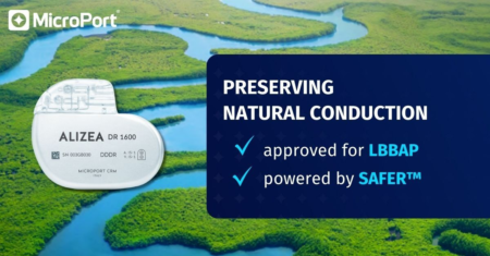 ALIZEA™ 2 Alizea visual 1