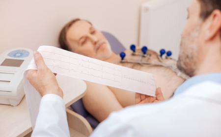 Bradycardia Bradycardia Slow Heart rate 3