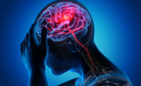 Stroke Hemorrhagic Stroke Disease 1