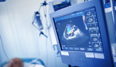 Aortic Aneurysm Abdominal aortic aneurysm (AAA) Diagnosis 2