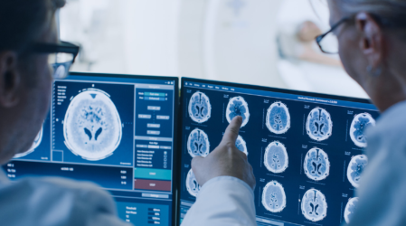 Stroke Ischemic Stroke Diagnosis 4
