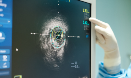 Arteriosclerosis Arteriosclerosis Obliterans Diagnosis 2