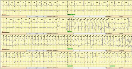 SPIDERFLASH Eventscope v2 1