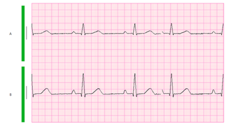 SPIDERFLASH Hookup3 Impedance check 1