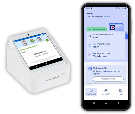 SmartView Connect Smartview connect 1